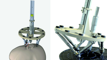 Assistenzroboter für die Chirurgie