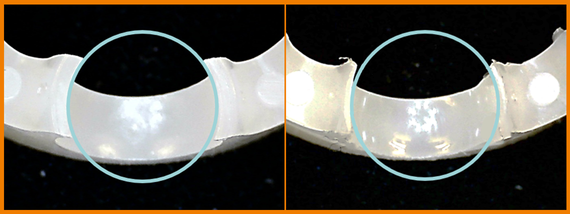 xirodur® Material im Test